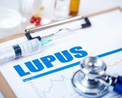 What is Lupus