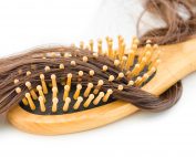 hormonal hair loss